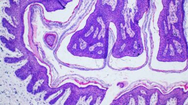 These Genes Determine How Your Body Regulates & Distributes Fat