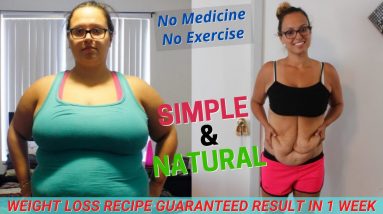How to lose Weight FAST without Medicine And Exercise | My Weight Loss Transformation Story