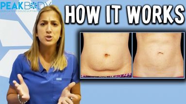 How Does CoolSculpting Work? | Best Way To Lose Belly Fat?!