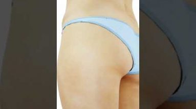 Exipure can change your life. in    weightloss  jurney 👉link in discription👇 #shorts